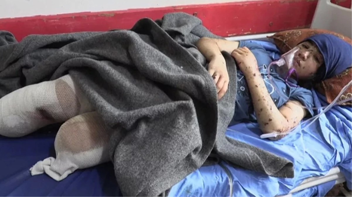 İki bacağını kaybeden Gazzeli kızın sözleri yürek dağladı: Gelecek diye bir şey yok, protez bacaklar istemiyorum
